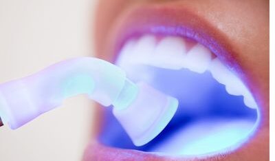 Dental Filling Curing Light