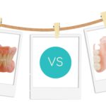 Full or Partial Denture Options