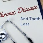Tooth Loss and Chronic Disease