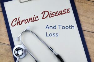 Tooth Loss and Chronic Disease