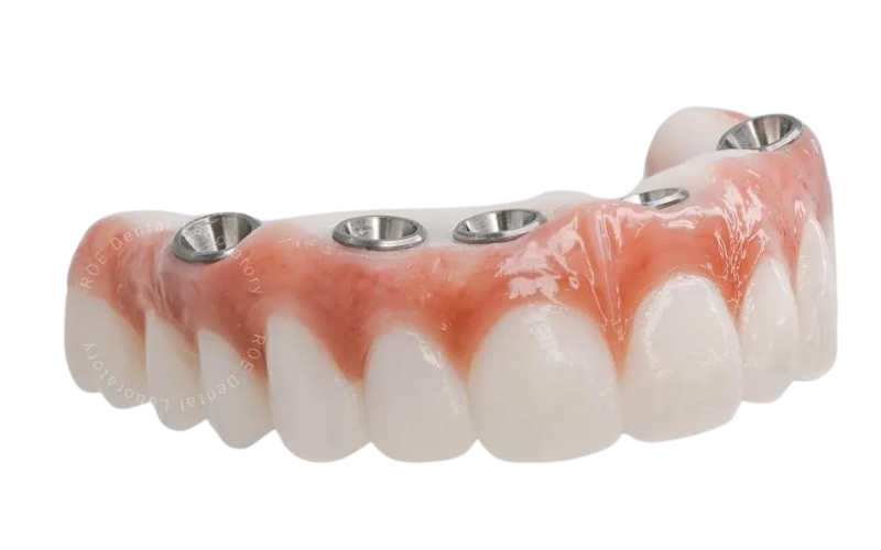 AO4-Implant-Device-Banner