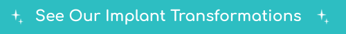 See Our Implant Transformations Header