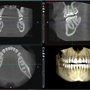 CBCT - Scan Image
