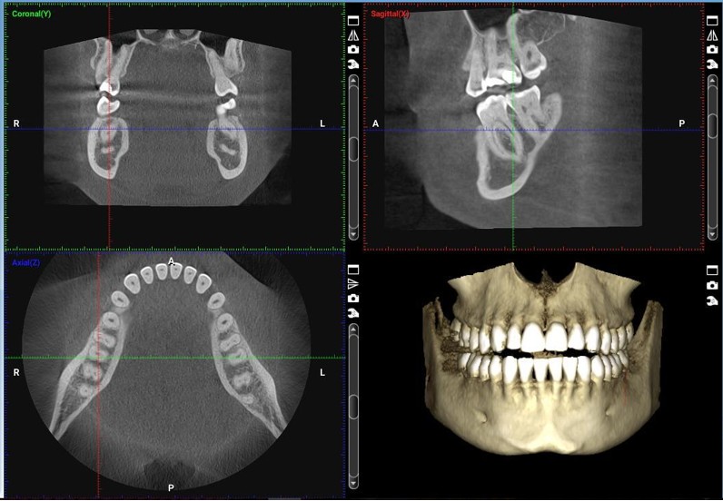 CBCT - Scan Image