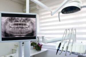 Why Dental X-Rays Matter