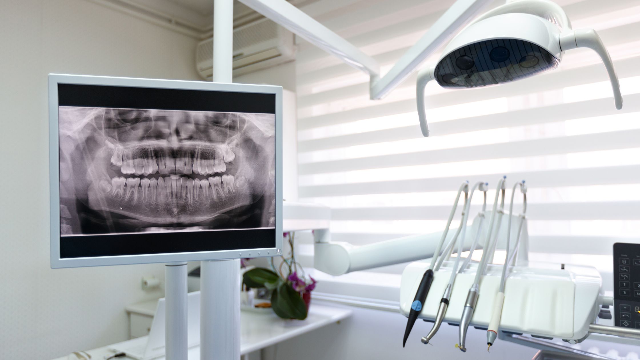 Why Dental X-Rays Matter