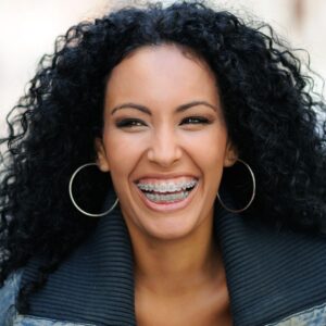 Palate Expander Adult Braces